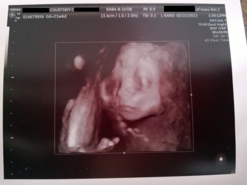 Here is Wilson, looking cute and HEALTHY!